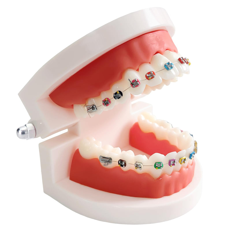 Dental Orthodontic Teeth Model with Colorful Braces, Professional Denture Mouth Model Demonstration Study Tool for Dentistry Students and Orthodontists, Tooth Teaching Equipment with Bracket Supplies