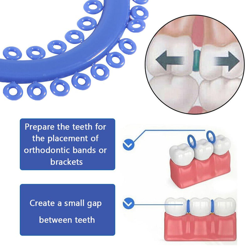 Dental Orthodontic Braces Separator - Elastic Orthodontic Ligature Ties O Ring Rubber Band for Teeth, Latex Free (700 PCS)