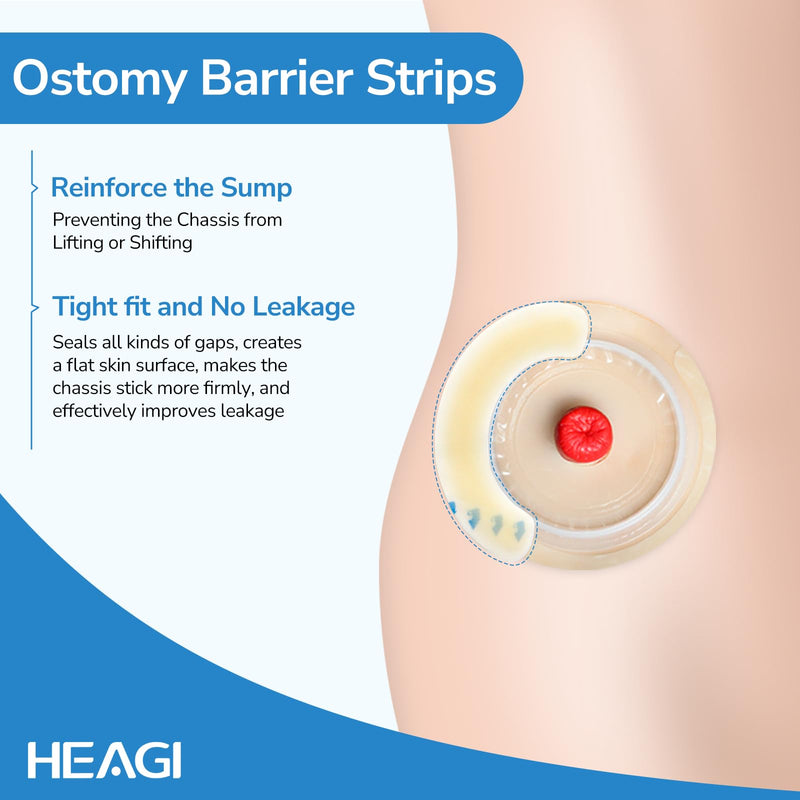 [Australia] - 20PCS Ostomy Barrier Strips, Skin-Friendly Hydrocolloid Skin Barrier Strips, Elastic Barrier Strips for Ostomy Bag Ostomy Colostomy Ileostomy Supplies 20pcs Ostomy Barrier Strips 