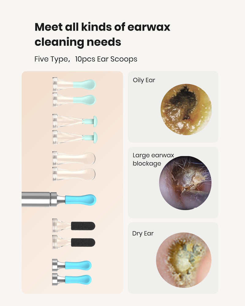 [Australia] - BEBIRD R1 Ear Wax Removal Tool - Spade Ear Cleaner with Ear Camera, 1080P Ear Scope, Earwax Remover Picker with 10 Replacement Tips Ear Pick with 6 LED Light for Earwax Cleaning, Support iPhone, Black 