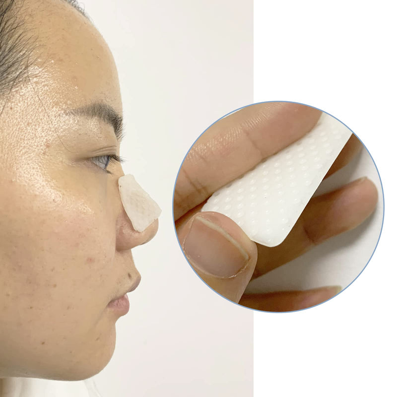 Mediss Thermoplastic Nasal Splints, External Nose Support Protector for Rhinoplasty Septoplasty Surgery, Nose Brace Fracture, ENT, Orthopedic Immobilization, 5pcs-L Size(B)