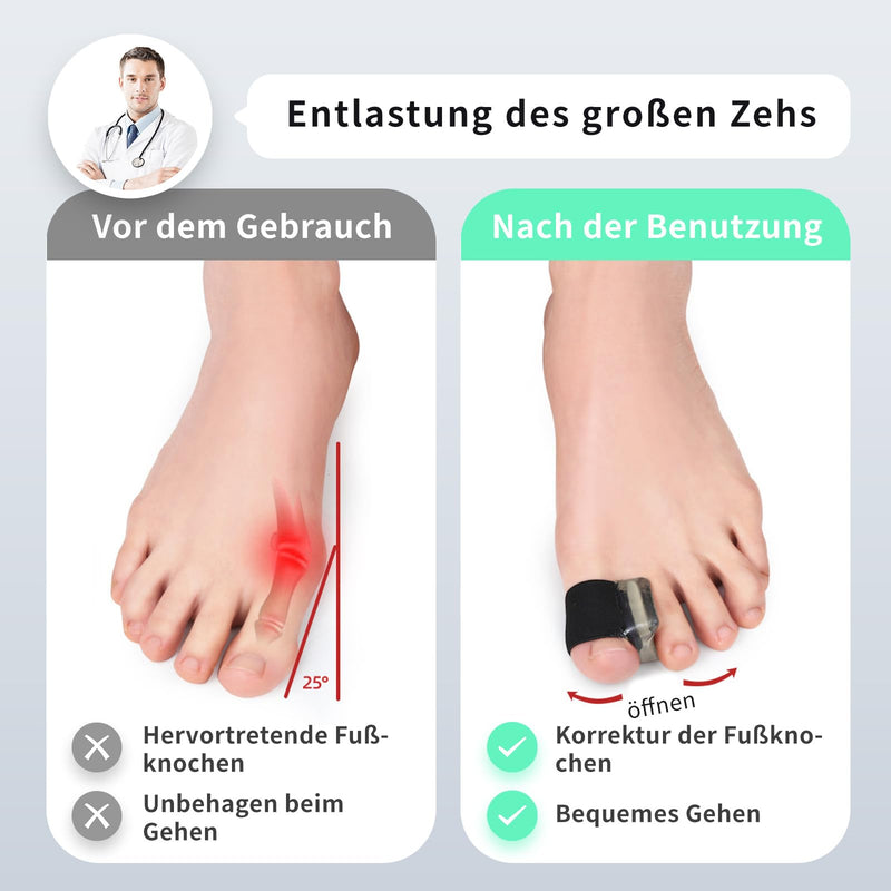 [Australia] - Toe Separator Hallux Valgus Correction Silicone, Pack of 8 Toe Separators for Women, Hallux Valgus Splint Bandage, Toe Spacer, Hammer Toe Correction, Toe Separator Big Toe 