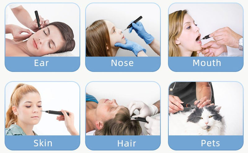 [Australia] - T2 Wireless Wifi Smart Otoscope Earwax Removal Tool Ear Endoscope with Led Light Visual Ear Scope for Adults and Children 