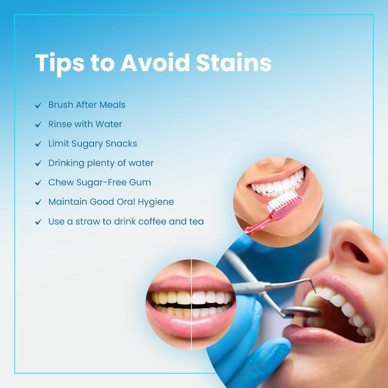 AlignerCo Wired LED Teeth Whitening Kit | Includes 3 (2ml) Whitening Gel Pens, 16-Bulb LED Light Mouthpiece | Gentle & Enamel Safe | Portable & Convenient Tooth Care