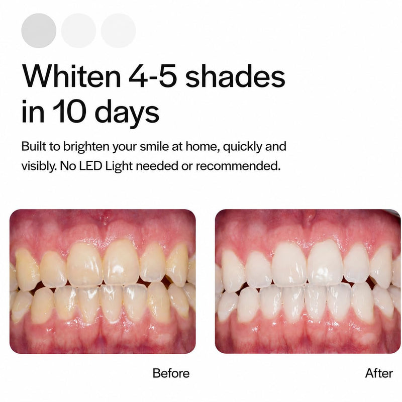 Opalescence Go 15 - Prefilled Teeth Whitening Trays Bundle 6238-1TS | Hydrogen Peroxide 15% - Includes Original Whitening Toothpaste Travel Size 1 Oz & Tongue Scraper (7 Treatments) Mint Flavor 7 Treatments / Original TP/ Tongue Scraper