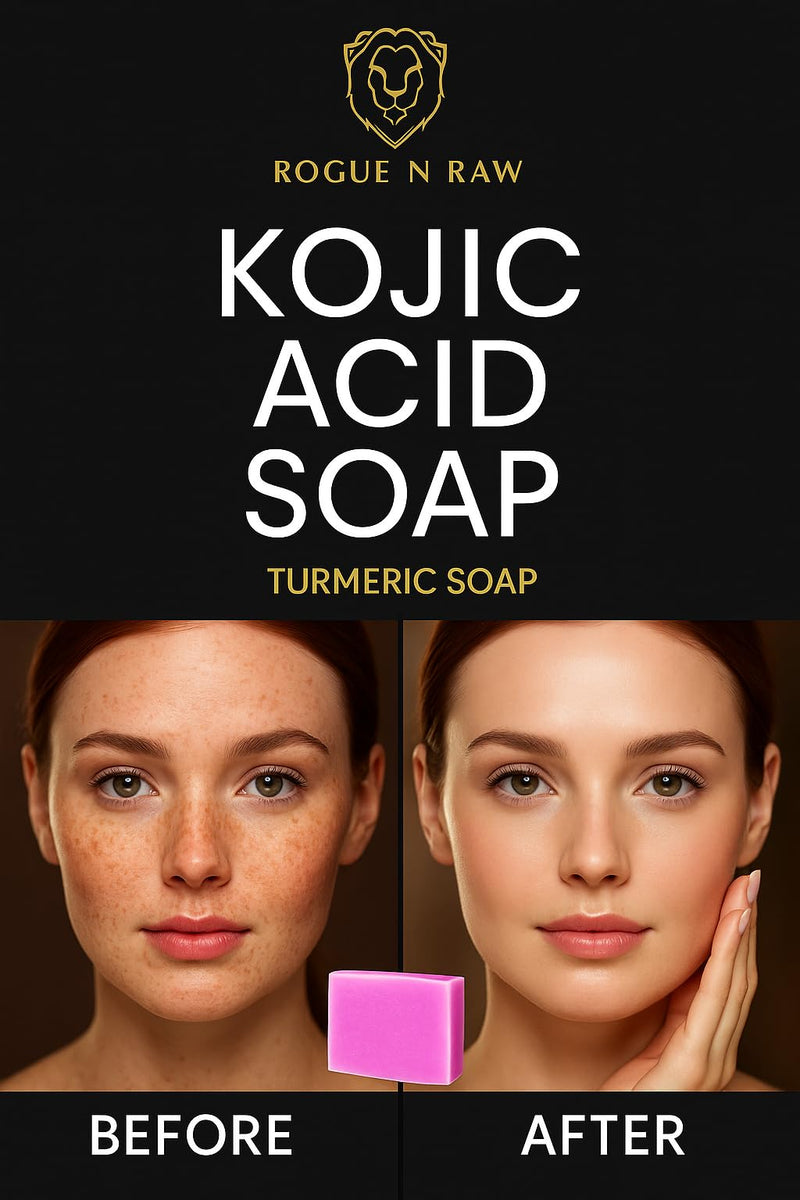 Turmeric Kojic Acid Soap Bars with Retinol, Collagen, Vitamin C & Glycerin - Natural Skin Brightening Soap for Dark Spots, Acne Scars & Even Tone - 2 Bars, 100G each