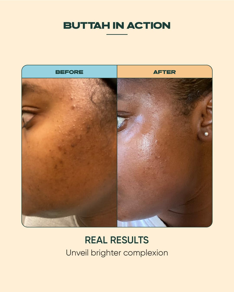 Buttah Skin 15% Vitamin C Serum 1 FL oz 30mL - For Uneven Skin Tone - Ferulic Acid - Anti-Dark Spot Vitamin C Serum For Face