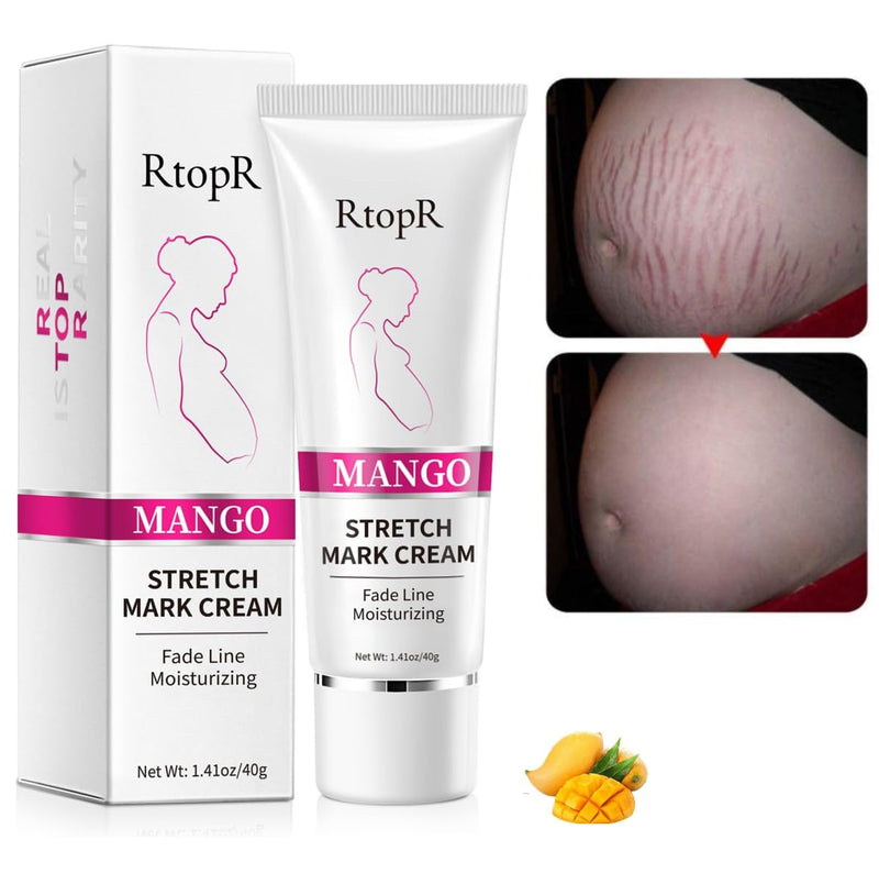 [Australia] - Stretch Mark Removal Cream, Obesity Stretch Mark Moisturizer, Postpartum Repair Stretch Mark Cream, Abdominal Stretch Mark Cream, Remove Marks (1 PCS) 1 PCS 