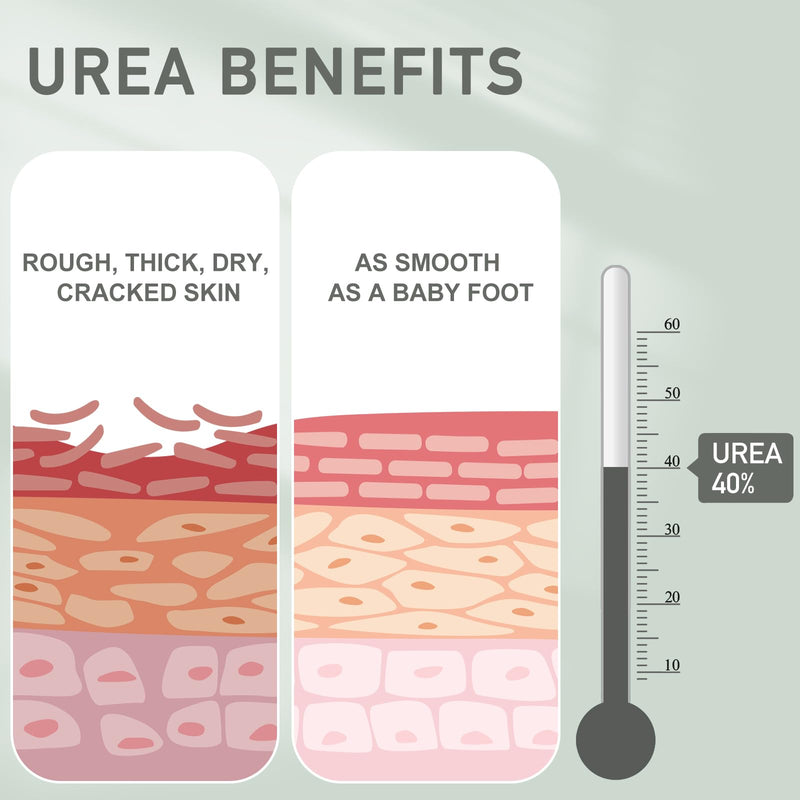 [Australia] - 3 Packs Urea Cream 40 Percent - Foot & Hand Cream, for Dry, Cracked Heels, Feet, Knees, Elbows, and Hands, Callus Remover, Maximum Strength Urea Lotion for Softening and Moisturizing 5.29 Ounce (Pack of 3) 