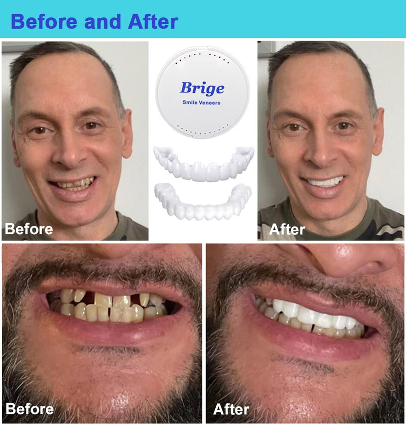[Australia] - Denture Smile Teeth Customizable Temporary Perfect Fake Teeth Molds Braces for Snap in Instant &Confidence Smile 