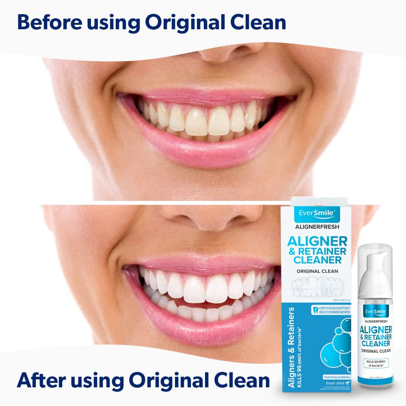 [Australia] - EverSmile AlignerFresh Original Clean-The Original Cleaning WhiteFoam On-The-Go Clear Retainer Cleaner. Eliminates Bacteria, Whitens Teeth & Fights Bad Breath (50ml - 2 Pack) 1.69 Fl Oz (Pack of 2) 