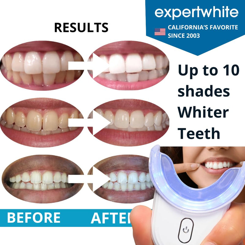 [Australia] - Instant Glo Teeth Whitening Kit with 32x LED Accelerator Light, Best Smile Whitener Gel Pens. Fast Results, for Sensitive Teeth, Enamel-Safe, Dentist-Trusted Incl. Mouth Tray, UV Light Whitening Kit 