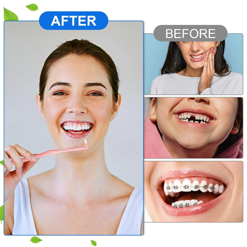 [Australia] - ACWOO Tufted Toothbrush, Pack of 8 Single Tufted Brush Toothbrush Small Toothbrush Tufted Brush Soft Tufted Toothbrush Trim Toothbrush Single Interdental Space Brush for Detail Cleaning 