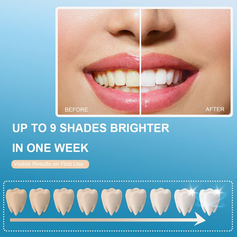RVEYi Teeth Whitening Kit for Sensitive Teeth with LED Light, 35% Carbamide Peroxide Gel Syringes and Remineralizing Gel, Blue