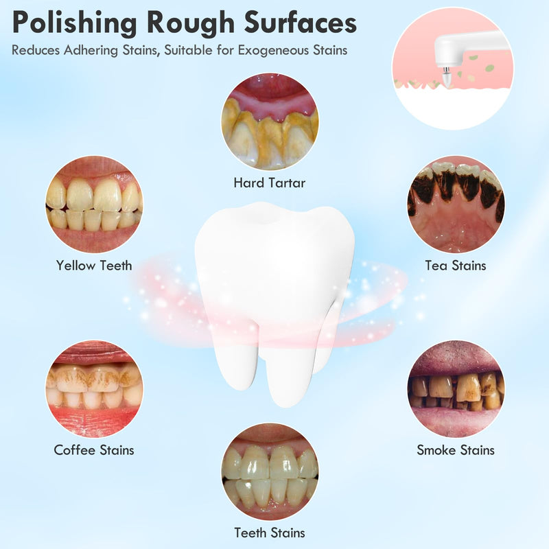 [Australia] - Rechargeable Tooth Polisher Kit for Daily Cleaning, Whitening and Polishing, Electric Dental Teeth Polisher with LED Light, 5 Brush Heads, 5 Speed Modes, Waterproof 1 Count (Pack of 1) White 