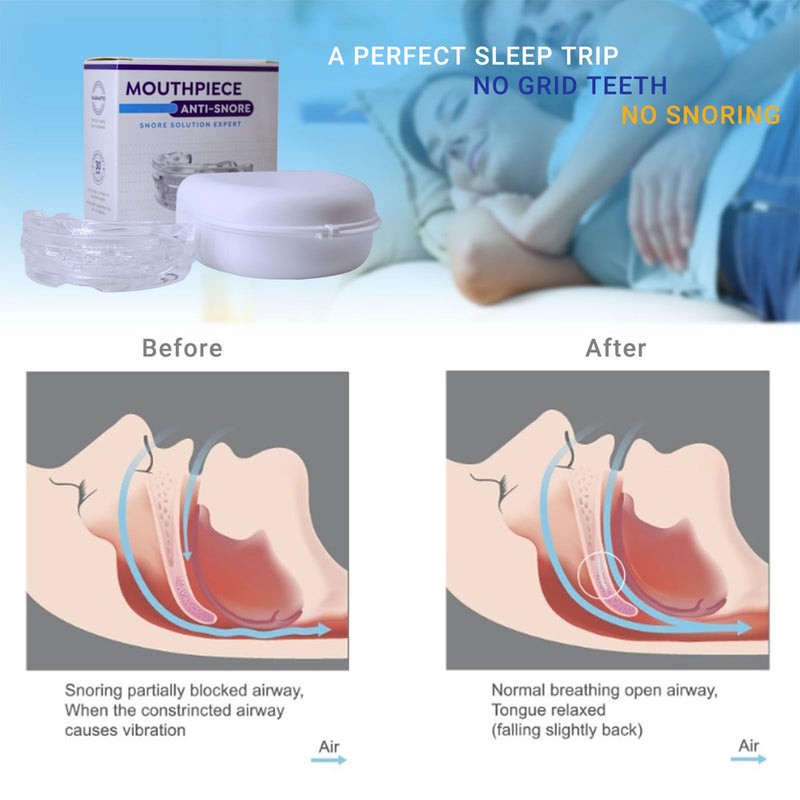 [Australia] - Dreamhero mouth guard, Dreamhero anti-snoring mouth guard, snoring stopper for anti snoring devices, Dreamhero mouth guard for snoring men and women 