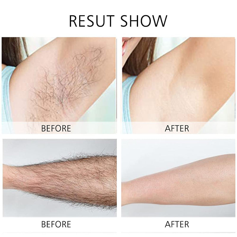 [Australia] - Women's Electric Shaver Replacement Heads : 5 Legs Hair Removal Razor Replacement Heads 4D Floating Heads Replacement Blades for Women 