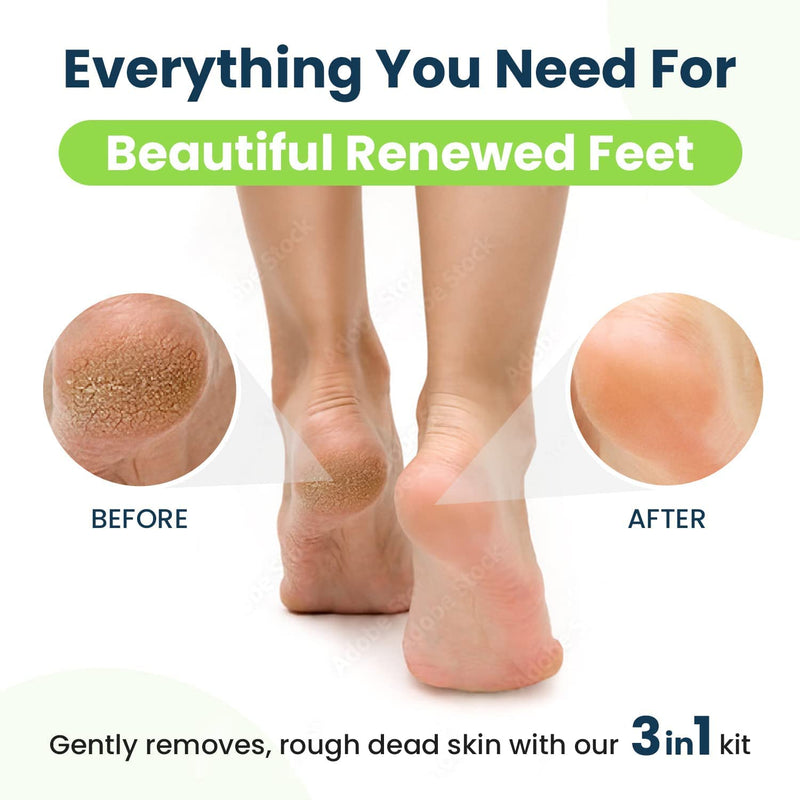 [Australia] - Muscle Relief Foot Soak with Epsom Salts - All Natural Salts for Post Workout - Easy Way to Remove Hard Calluses & Dead Skin Build-Up - Professional at Home Foot Care for Men & Women - Made in The USA 