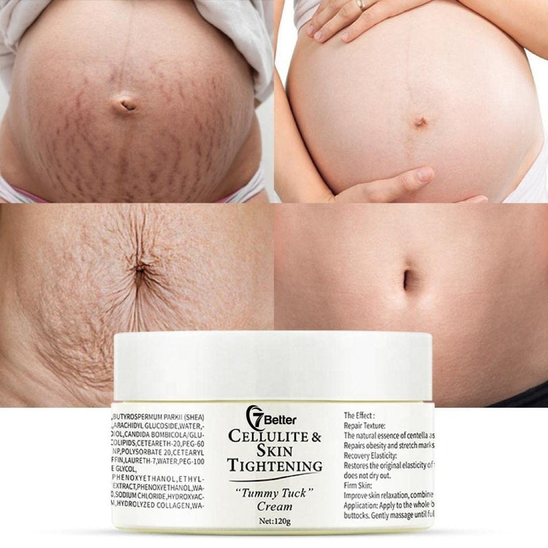 [Australia] - Stretch Marks and Scars Removal Cream for Pregnancy - Scars Repair, Abdominal Firming, and Gentle Stretch Marks Eradication Skincare Body 