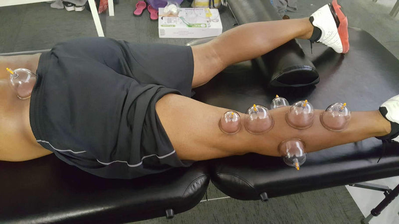 [Australia] - Cupping Set Professional Chinese Acupoint Cupping Therapy Sets Portable, Suction Hijama Cupping Set with Vacuum Magnetic Pump Cellulite Cupping Massage Kit 22-Cup 
