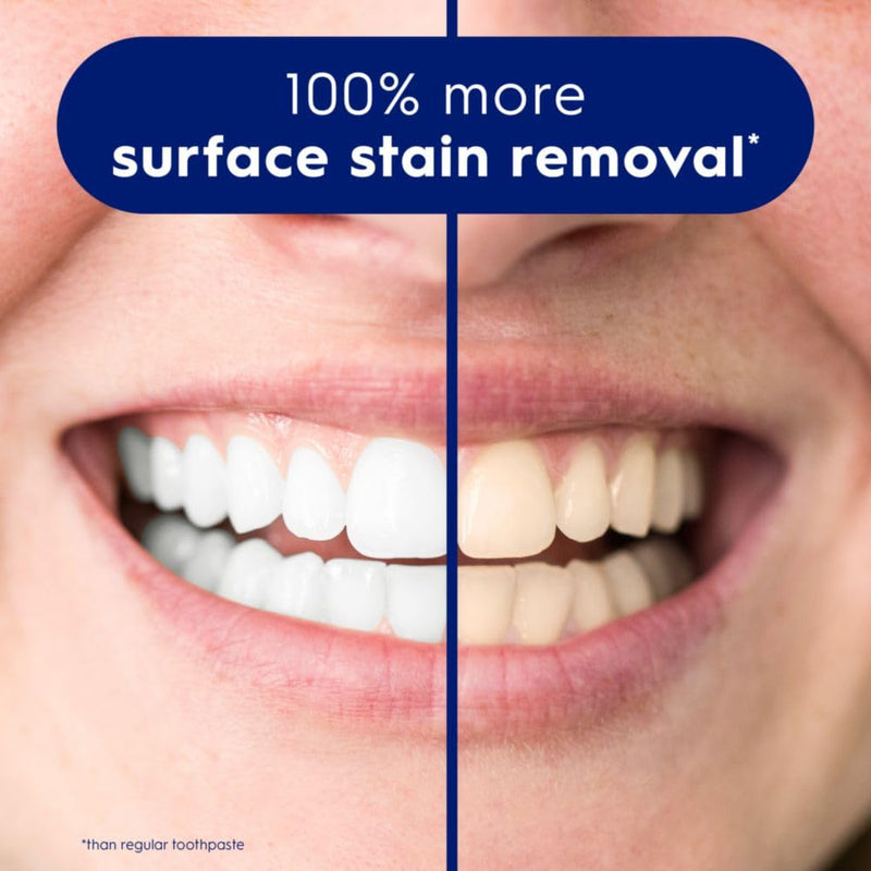 [Australia] - Crest 3D White Brilliance Bright Mint Teeth Whitening Toothpaste, 4.3 oz Pack of 3, 100% More Surface Stain Removal, 24 Hour Active Stain Prevention, Whiter Teeth in 3 Days 