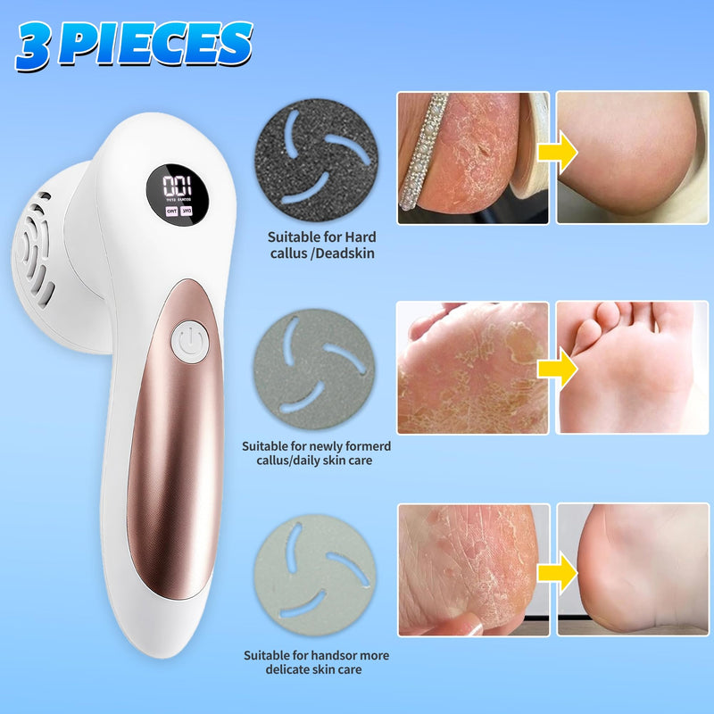 [Australia] - Electric Feet Foot Callus Remover Equipped with A Vacuum System Foot Scrubber 17 in 1 Professional Foot Care Tool Ipx6 Waterproof Rating for Removing Hard Cracks Dryness and Dead Skin (White) White 