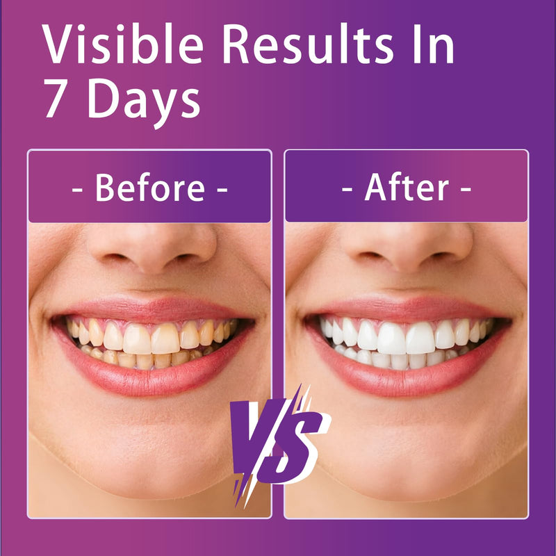 Purple Teeth Whitening Strips 14 Treatments, Whitening Strips for Sensitive Teeth and Enamel Safe, Teeth Whitening Effectively Remove Stains (28 Strips)