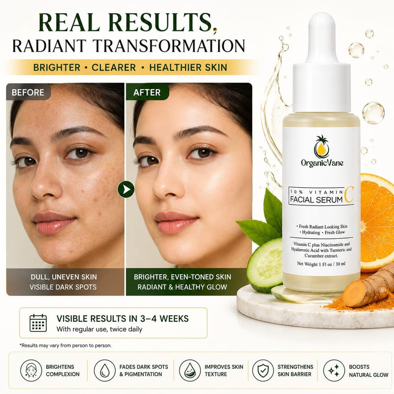 Vitamin C Serum 10% for Face – Powerful Anti-Aging Brightening Serum with Hyaluronic Acid, Niacinamide & Turmeric, Dark Spot Corrector, Reduces Wrinkles & Fine Lines for Youthful Glowing Skin, 1 oz