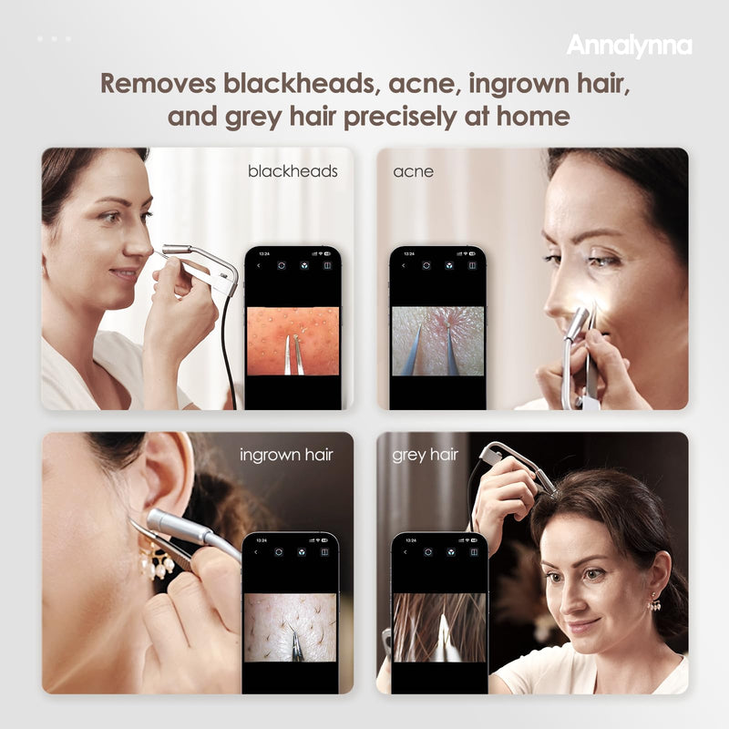 [Australia] - 6pcs Blackhead Remover Tweezers with Camera - 20x Magnification Pimple Popper Tweezers, Professional Pimples Comedone Extractor Removal Tool, Face Extraction Tool Kit for Deep Pore Cleaner 