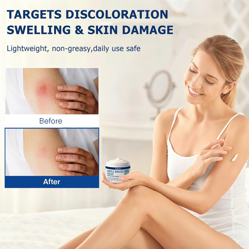 Arnica Bruise Cream Extra Strength,Fast-Acting for Bruising & Swelling on Thin Skin - Advanced Formula with Arnica Montana Vitamin K C & E - Soothing Hydrating for Face and Body 1pcs