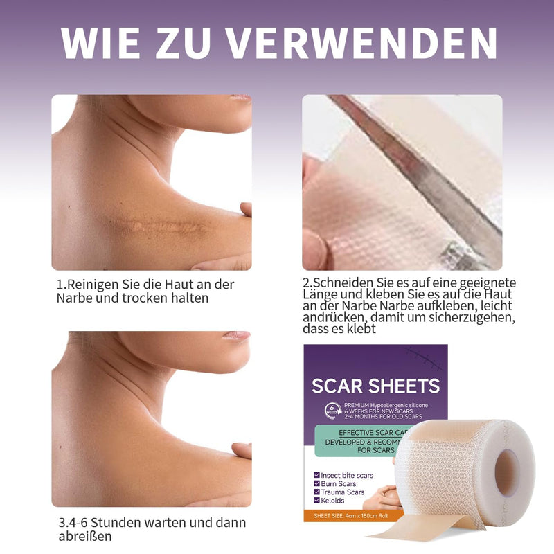 [Australia] - Scar plaster, silicone scar tape, silicone plaster for scars, silicone scar plaster, reusable silicone scar plaster, safe and effective (4 cm x 150 cm roll) Bluez1 