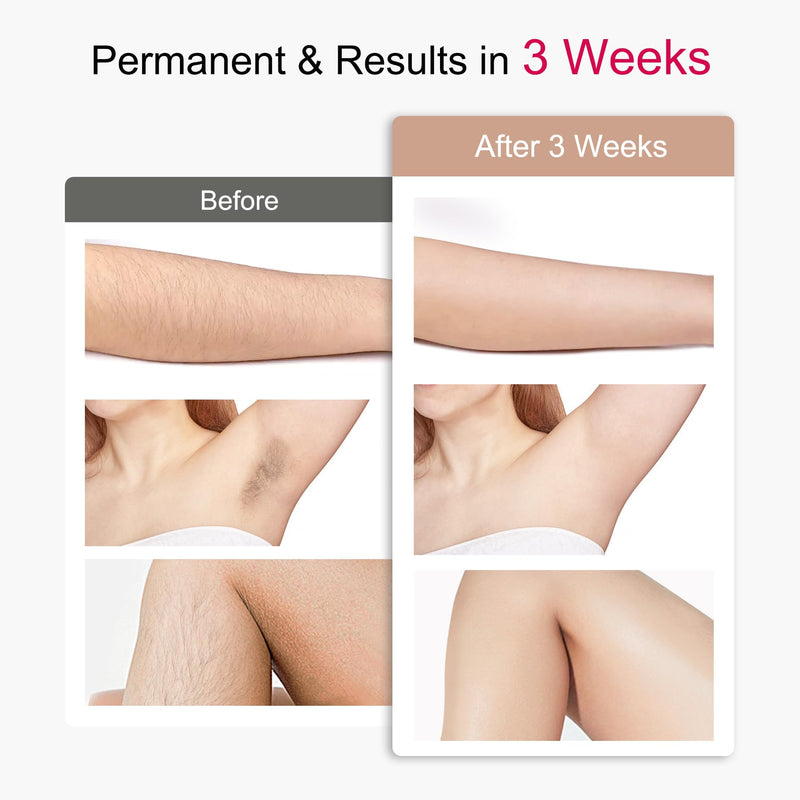 [Australia] - IPL Sapphire Laser Hair Removal Device for Women & Men with 45°F Ice-Cooling,Infinite Flash & Long-Lasting Results, Painless Hair Removal Device in 3 Weeks for Armpits Legs Arms Bikini Line At Home White-04 