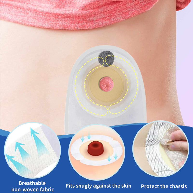 [Australia] - Ostomy Barrier Strips,Ostomy Supplies,Elastic Skin Barrier Strip, Ostomy Barrier Tape extenders for Skin Adhesive colostomy Bags (20pcs) 20pcs 