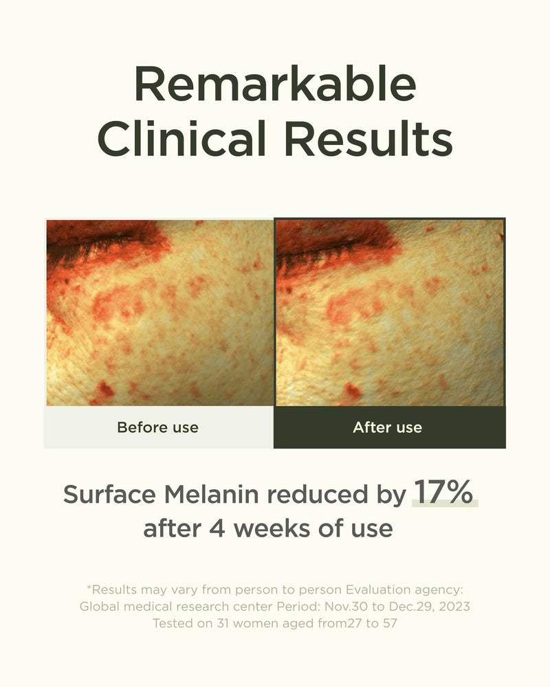 OURWHY Calendula Vita Serum (1.35fl oz) - Hydrating Serum for an Even Skin Tone Infused with Calendula Extract, Vitamin C Derivatives, and Soothing Ingredients