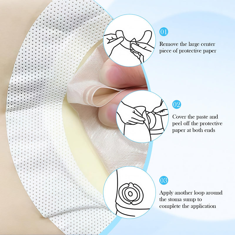 Tape Strips for Stoma Bags, 60pcs Curved Ostomy Barrier Tape, Stoma Skin Barrier Strips, Elastic Stoma Protection Tape, for Colostomy, Urostomy, Ileostomy Supplies