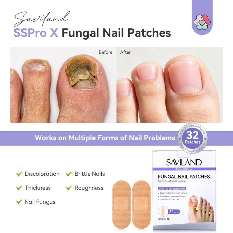 SAVILAND Fungal Nail Patches 1% Tolnaftate for Overnight Nail Repair 32Pcs | FSA-HSA, 8H Deep Overnight Repair, Reduces Yellow & Thick Nails, Breathable Materials Adhere Securely, Damaged Toenail Care 32 Patch