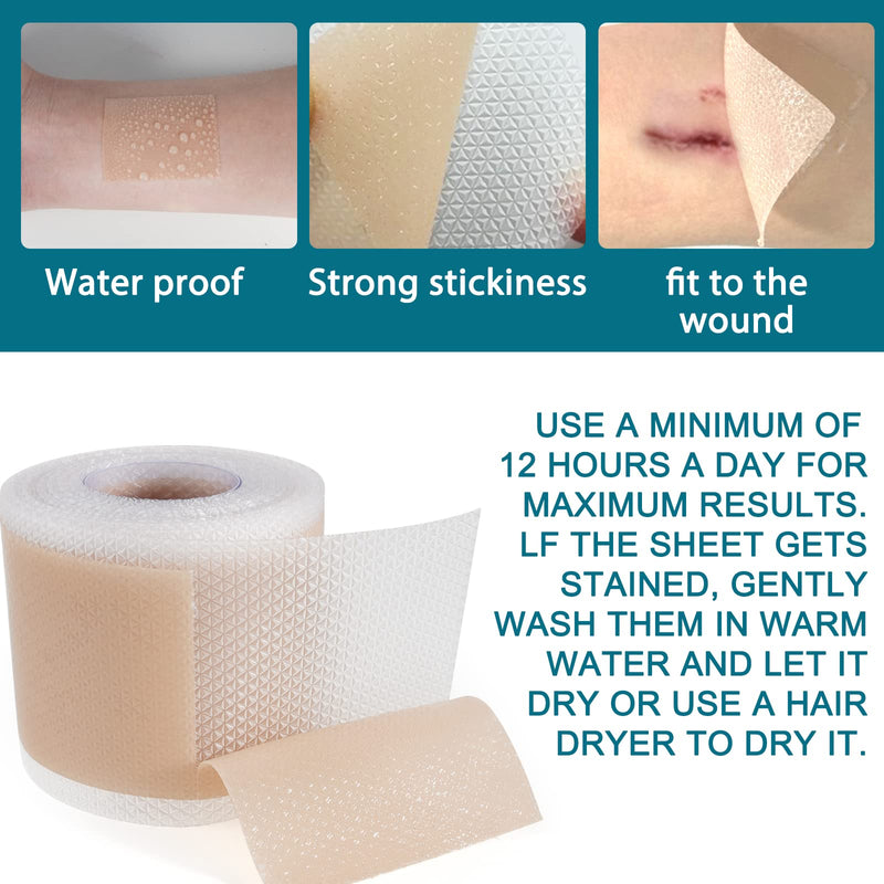 [Australia] - Silicone Scar Plaster, Professional for C-Section Scars, Surgery, Burns, Keloid, Acne and More, Drug Free, Silicone Scar Roller(4CMx300CM) 4CMx300CM 