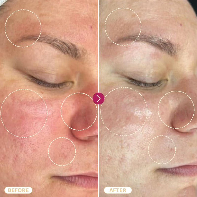 [Australia] - BASE LABORATORIES Hypochlorous Acid Spray | Skin healing for wounds | Spray solution for wound care, eczema, tattoo and piercing aftercare | Wound irrigation with saline solution Hypochlorous Acid | 240ml 240ml (pack of 1) 