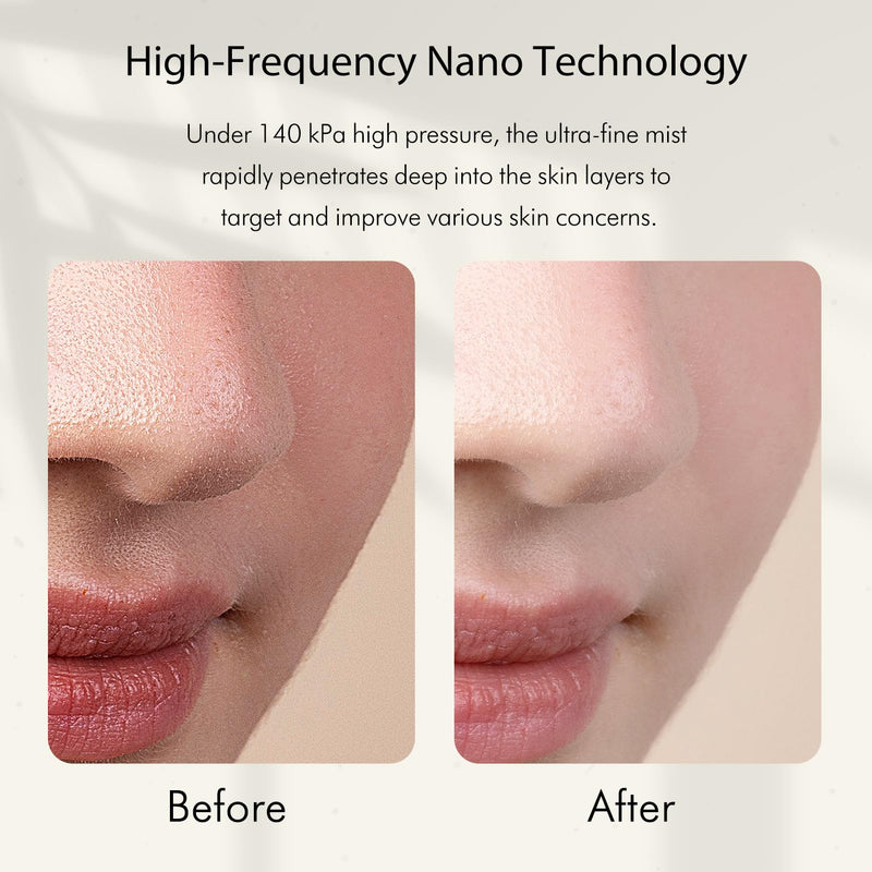 [Australia] - Facial Oxygen Spray Machine - High Pressure Nano Facial Steamer with 0.3mm Nozzle - Rechargeable Portable Nano Mist Injector Sprayer for Deep Moisturizing Face Skincare Green 