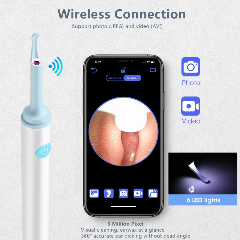 [Australia] - Earwax Remover Otoscope, LANMOU 1080P Wifi Ear Cleaner, Ear Cleaner with Camera, HD Otoscope with 6 LEDs & 4 Silicone Ear Spoons, Ear Cleaner for iPhone, Android, iPad, White 