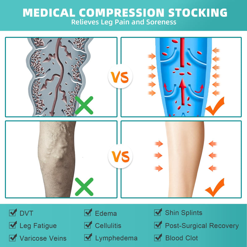 [Australia] - Evolyline Medical Compression Stockings for Men and Women 20-30 mmHg, Class II Thigh Long Compression Socks Support Stockings Footless with Silicone Band for Graduated Support Varicose Veins Black M 