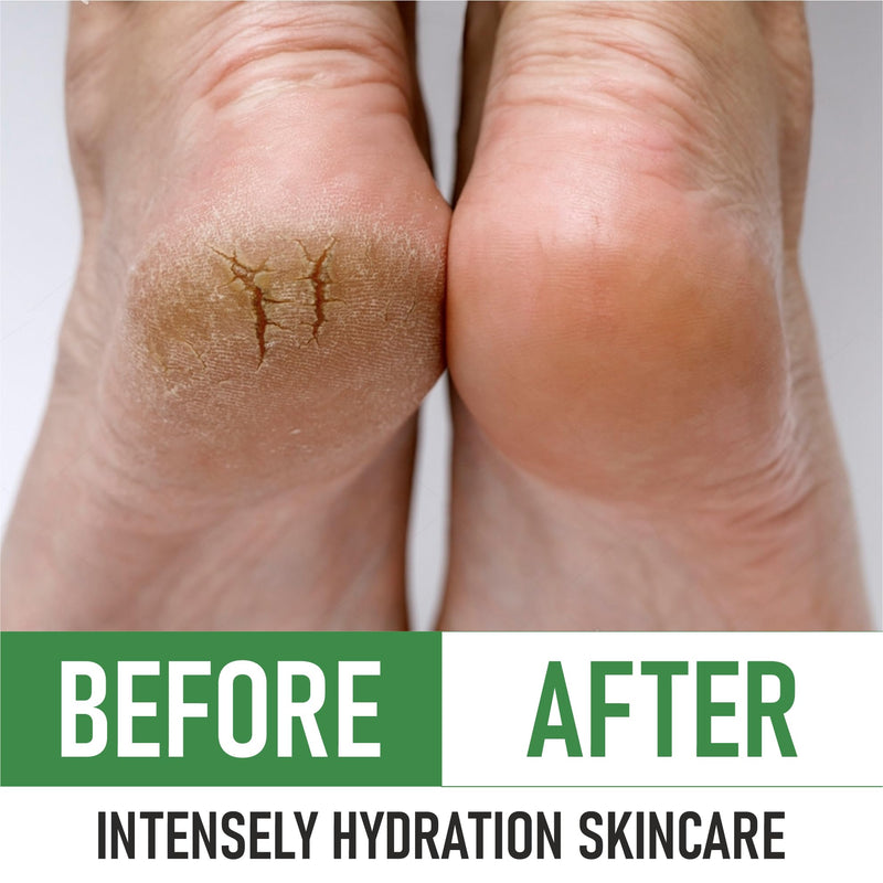 PurOrganica Urea Cream 40% – Made in USA, Maximum Strength Foot Cream for Dry, Cracked Heels, Corns, Calluses & Rough Feet, Exfoliating Moisturizer 4 Ounce (Pack of 1)