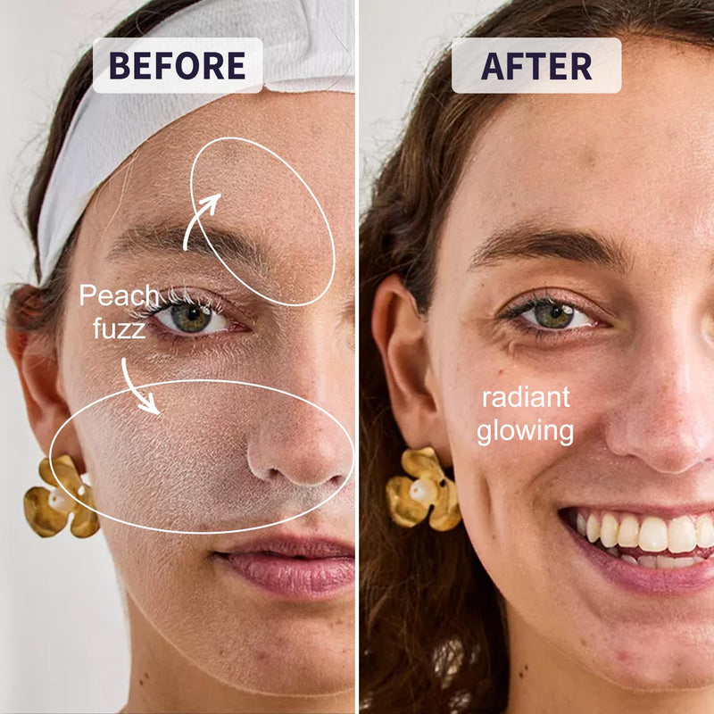 Dermaplane Razor - Facial Razor for Women - Dermaplaning Tool, with 19 Microblades for Face, Peach Fuzz Remover, Remove Facial Hair for Smoother Skin and Perfectly Shape Brows, Pearl Blush Pearl Blush Razor