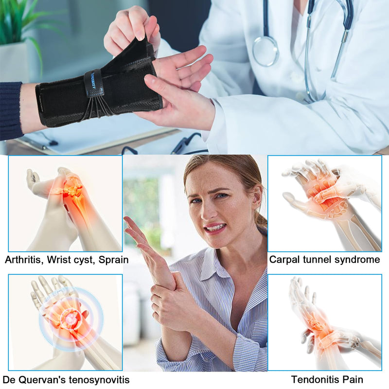 Wrist Brace with Thumb Spica Splint Support for De Quervain's Tenosynovitis,Carpal Tunnel Syndrome,Arthritis,Wrist ganglion cyst,Sprains&Forearm Support Cast(Left Hand,Small) Small Left Hand