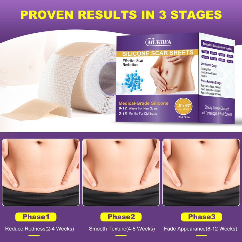 [Australia] - Silicone Scar Sheets, Silicone Scar Tape, Scar Tape for Keloid Bump Removal, Reusable Silicone Scar Strip for C-Section, Keloid, Surgery, Burns, Acne Scar et(1.6‚Äùx60‚ÄùRoll-1.5M) 1.5M (Pack of 1) 