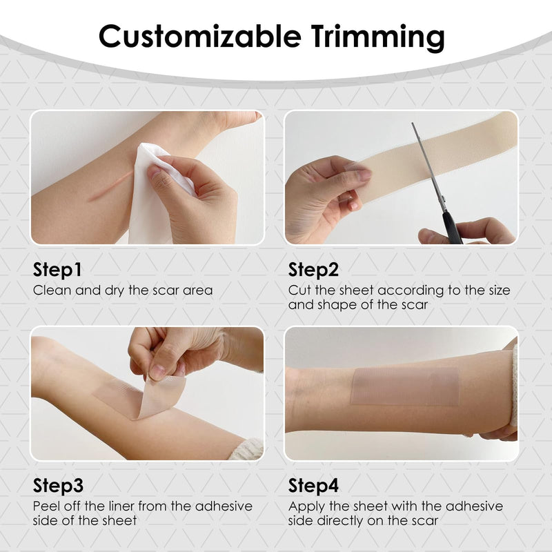 [Australia] - Silicone Scar Sheets,Silicone Scar Tape for Removal Treatment,Medical Grade Scar Tape for Surgical Scars,C-Section,Tummy Tuck,Scar Removal Away(1.6" x 60" Roll - 1.5M) Keloid Bump RemovalÔºå1PC 1.6" x 60" Roll - 1.5M 