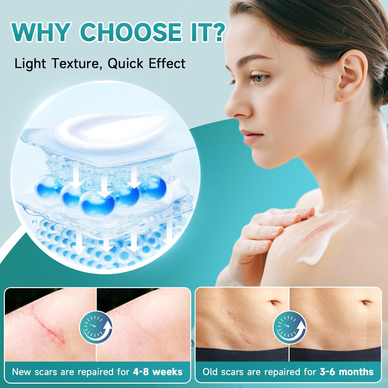 [Australia] - Advanced Scar Cream, Silicone Gel for Scars, Professional Scar Removal Cream for Surgical Scars, Stretch Marks, Old and New Scars 1.7 oz(50ml) 