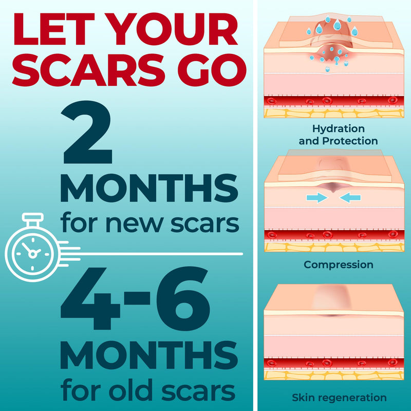 [Australia] - Medical Grade Silicone Scar Tape - 1.6‚Äùx150‚Äù - Visible Difference on Keloid & –°-Section - Reusable Silicone Scar Sheets - Easy to Use Beige 150"x1.6" 