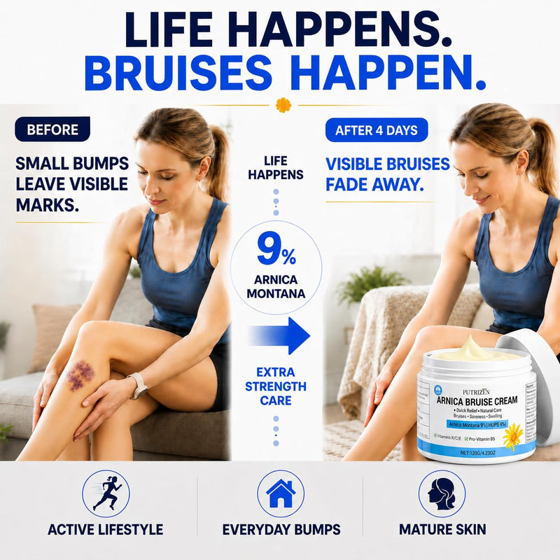 9% Extra Strength Arnica Bruise Cream for Pain & Swelling, 4.23 oz | Higher active concentration than familiar 7% formulas, plus Vitamins K, C, E & B5 in a fast-absorbing, non-greasy base