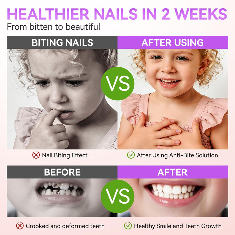Gelike ec Stop Kids Nail Biting: Strong Extra Bitter Polish for Children | Safe Non Toxic Japanese Vegan Organic Formula to Stop Nail Biting & Thumb Sucking - Long Lasting Clear Treatment for girls